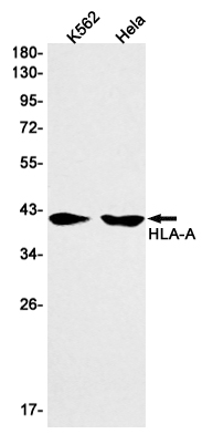 HLA A Rabbit mAb