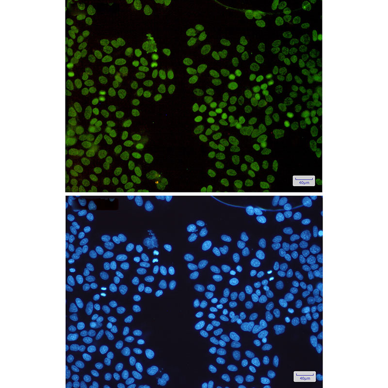 HMGA1 Rabbit mAb