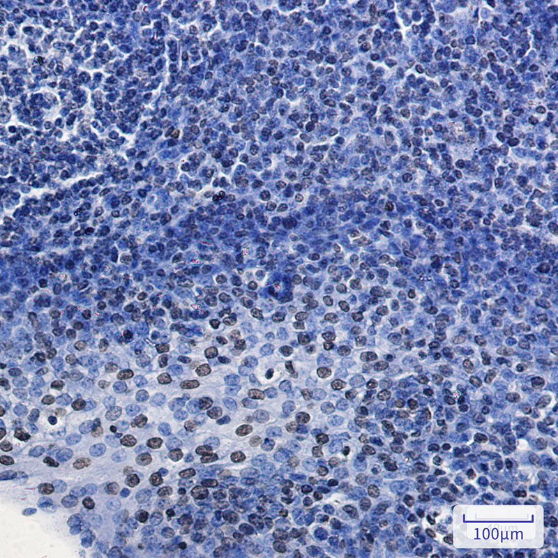 HMGA1 Rabbit mAb