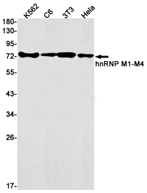 hnRNP M Rabbit mAb