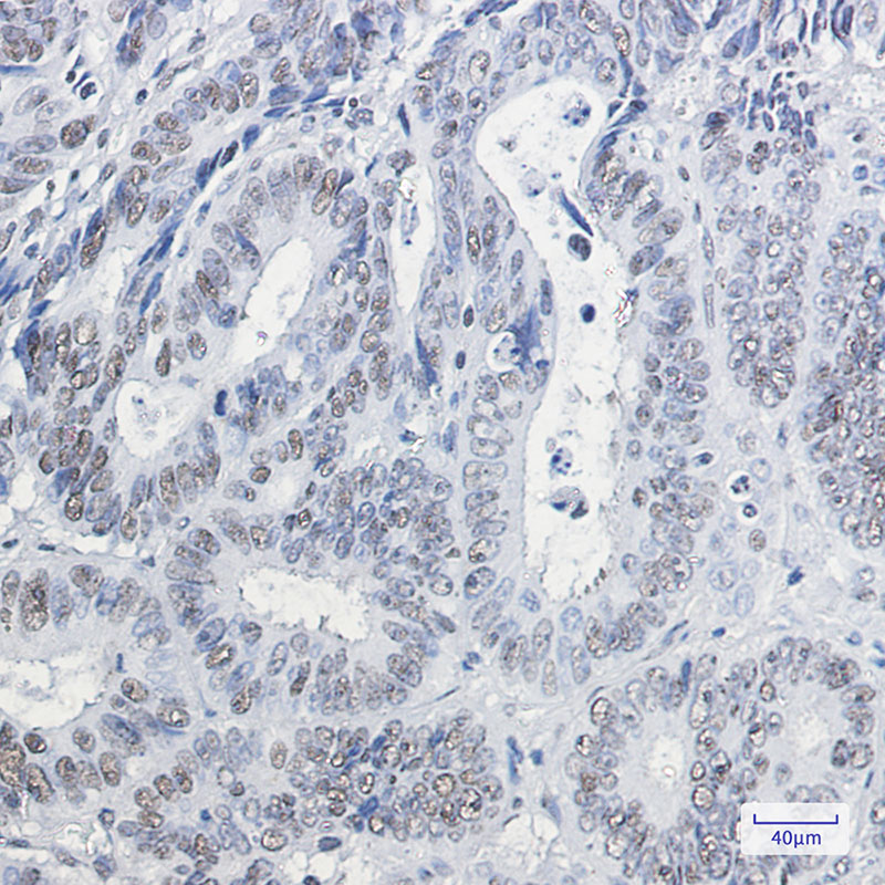 HP1 gamma Rabbit mAb