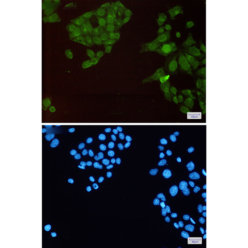 Phospho-HSF1 (Ser326) Rabbit mAb