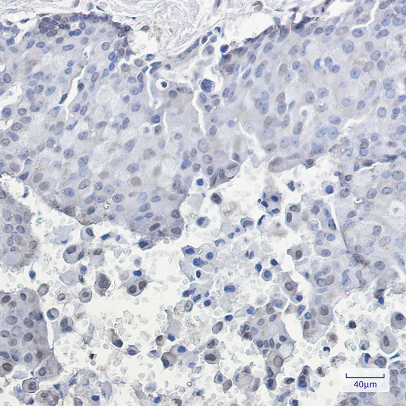 Phospho-HSF1 (Ser326) Rabbit mAb