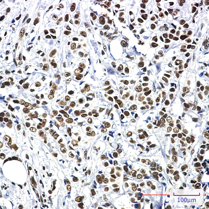 Hsf1 Rabbit mAb