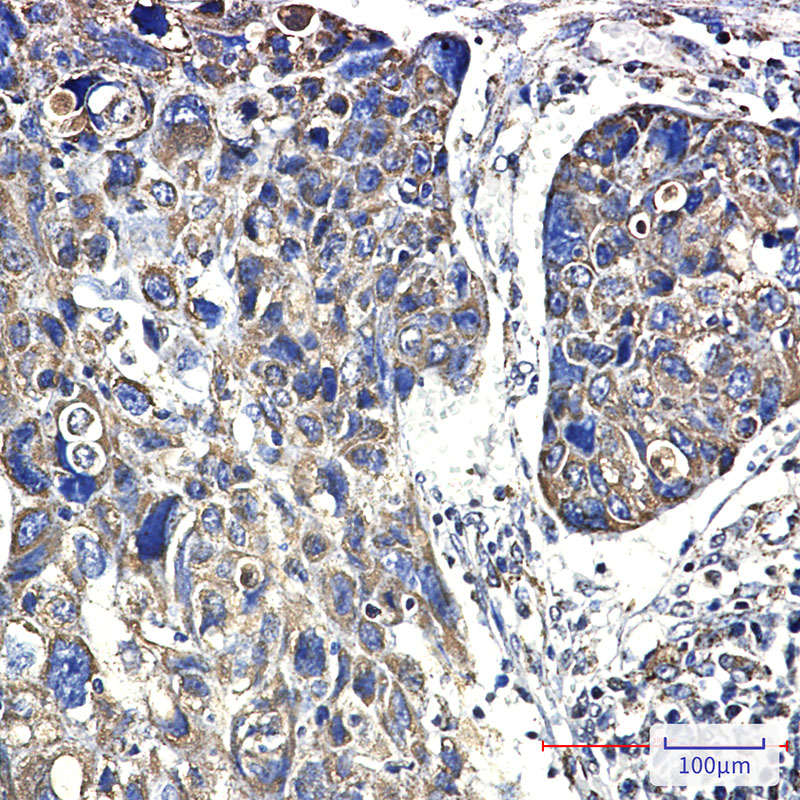 Hsp60 Rabbit mAb