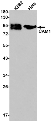 ICAM1 Rabbit mAb