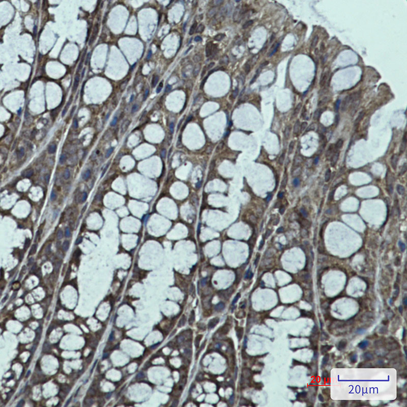 IGF2BP1 Rabbit mAb