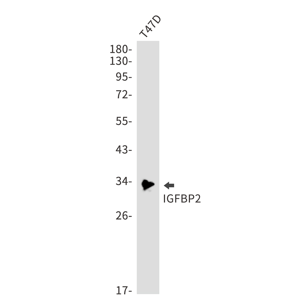 IGFBP2 Rabbit mAb