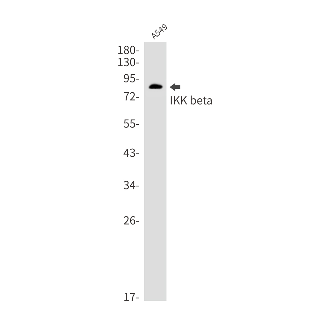 IKK beta Rabbit mAb