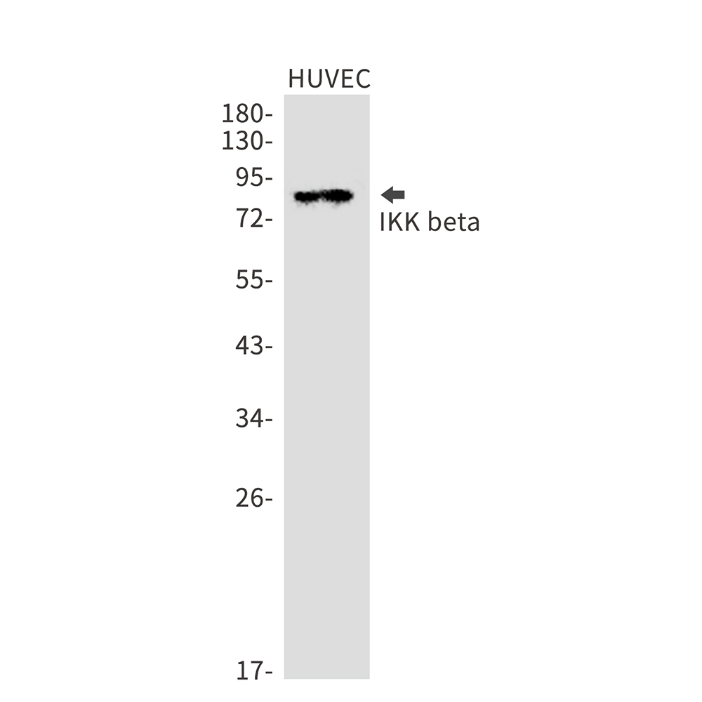 IKK beta Rabbit mAb