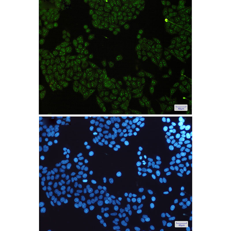 IKK gamma Rabbit mAb