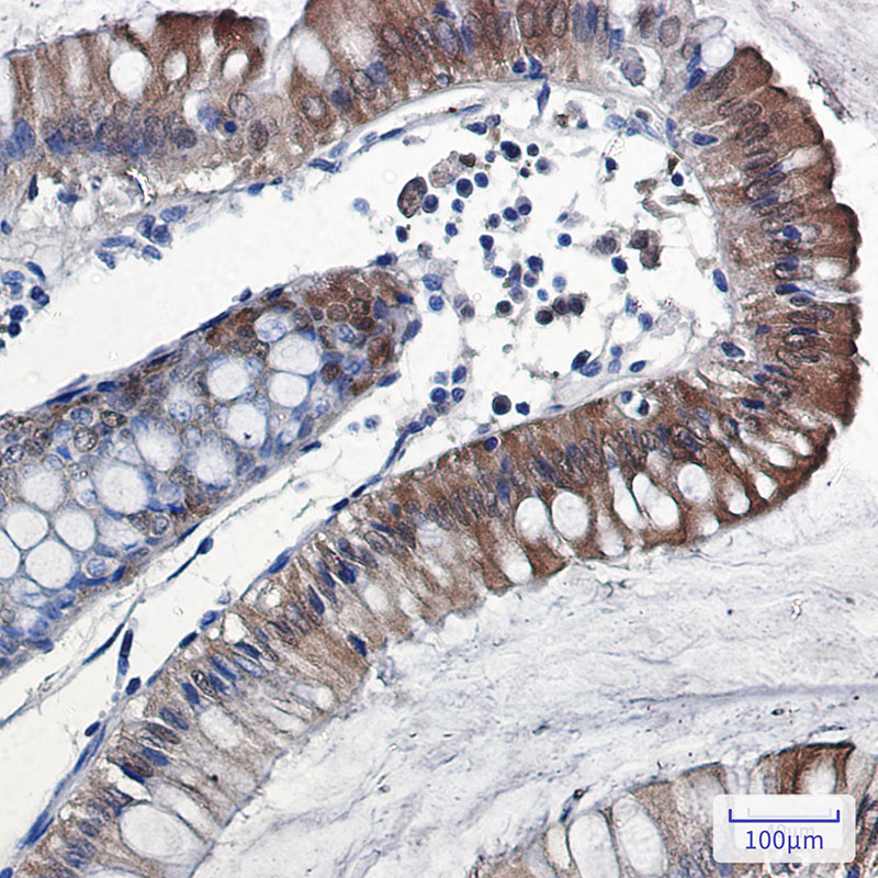 IL-18 Rabbit mAb