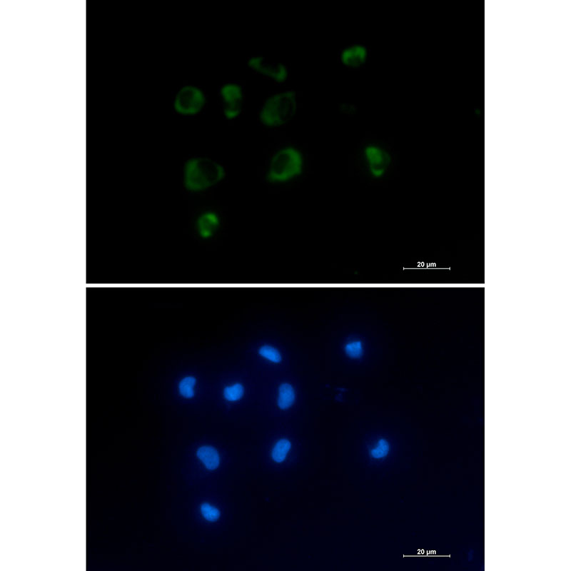 IL-1 Receptor Antagonist Protein Rabbit mAb