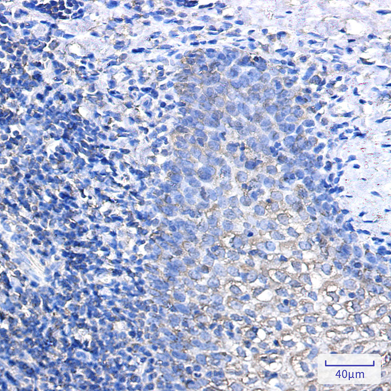 IL-1 Receptor Antagonist Protein Rabbit mAb