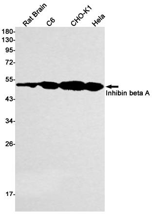 Inhibin beta A Rabbit mAb