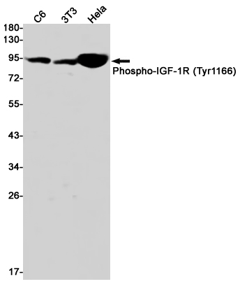 Phospho-IGF1 Receptor (Tyr1166) Rabbit mAb