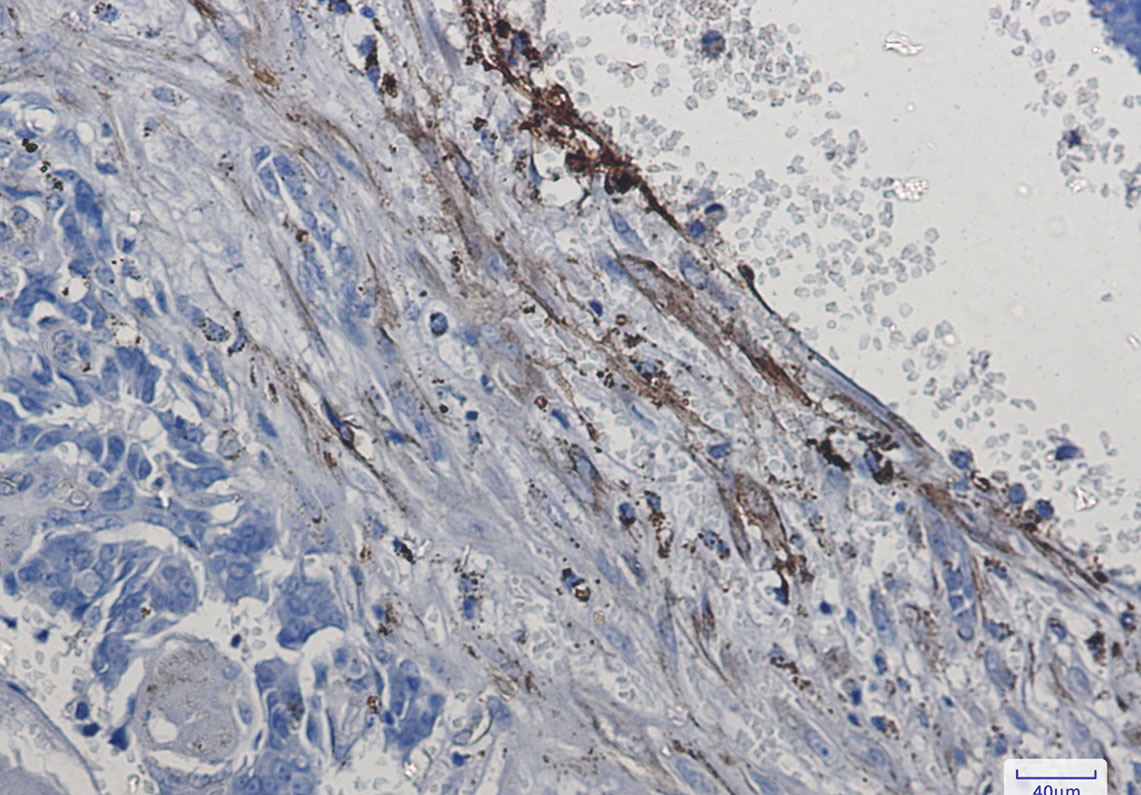 Integrin alpha 5 Rabbit mAb