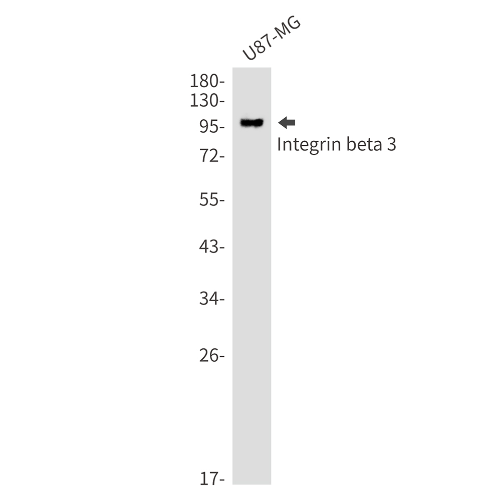 Integrin beta 3 Rabbit mAb