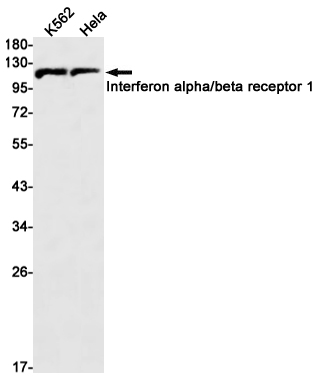 Interferon alpha/beta Receptor 1 Rabbit mAb