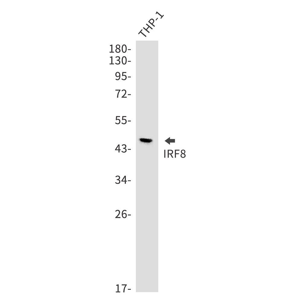 IRF8 Rabbit mAb