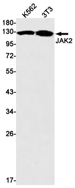 JAK2 Rabbit mAb