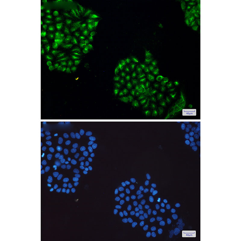 JNK Rabbit mAb