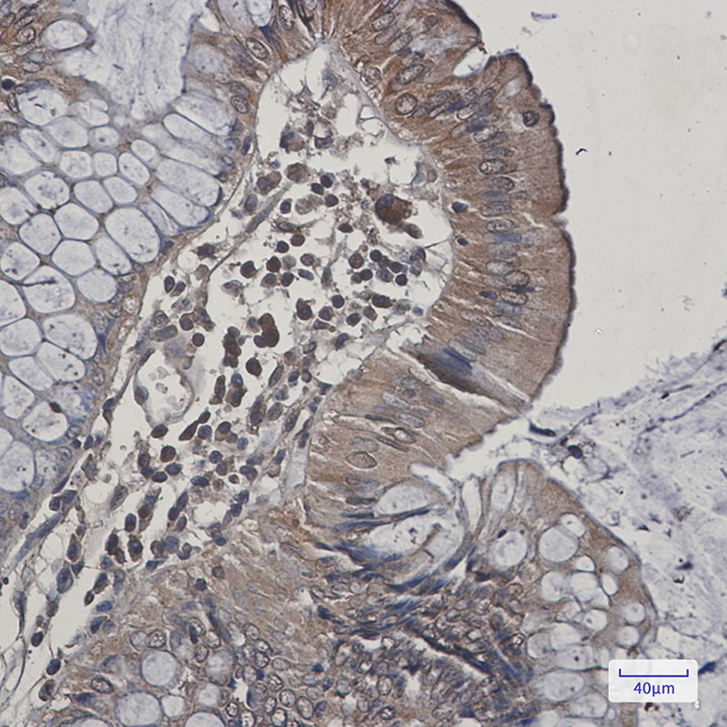 JNK2 Rabbit mAb