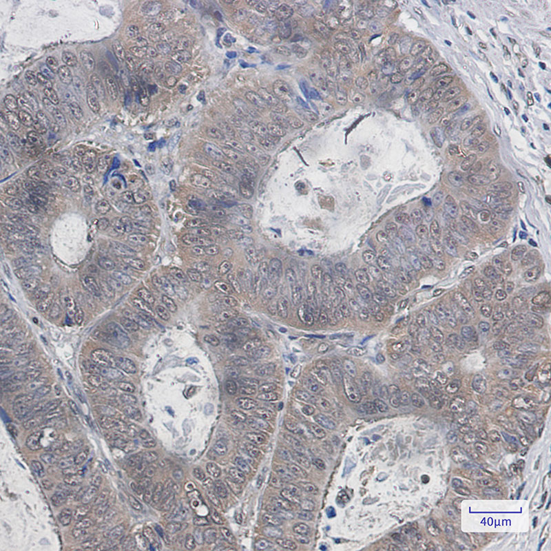 Ubiquitin K48 Rabbit mAb