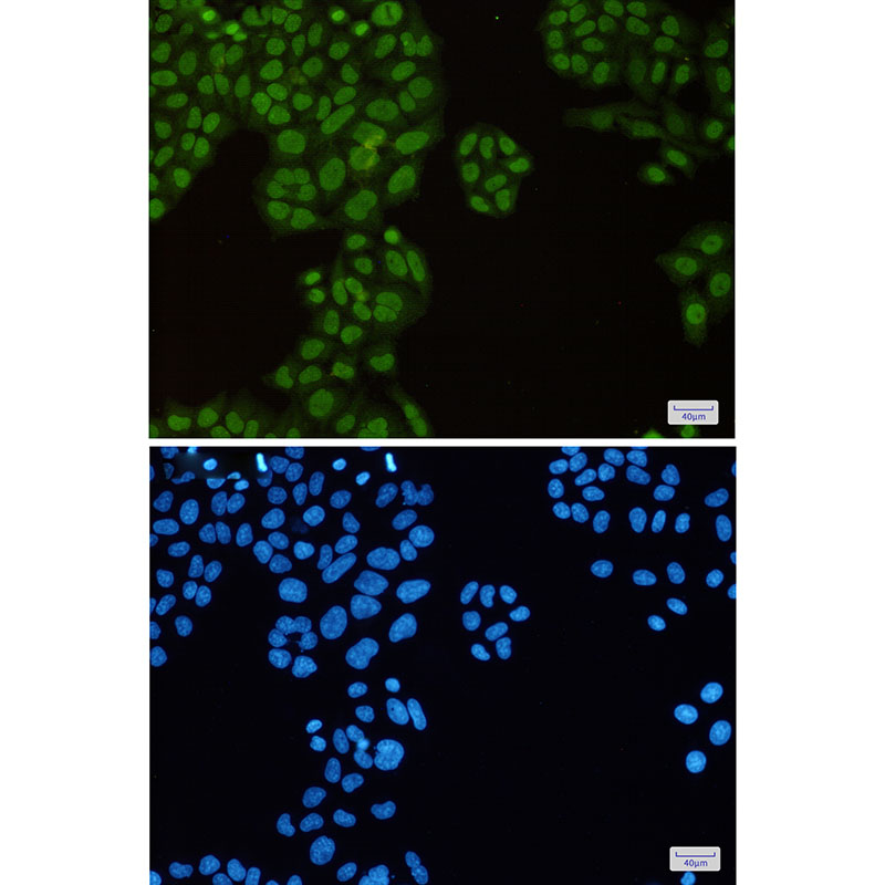 KAP1 Rabbit mAb