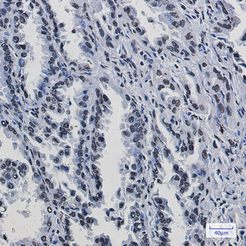 KAP1 Rabbit mAb