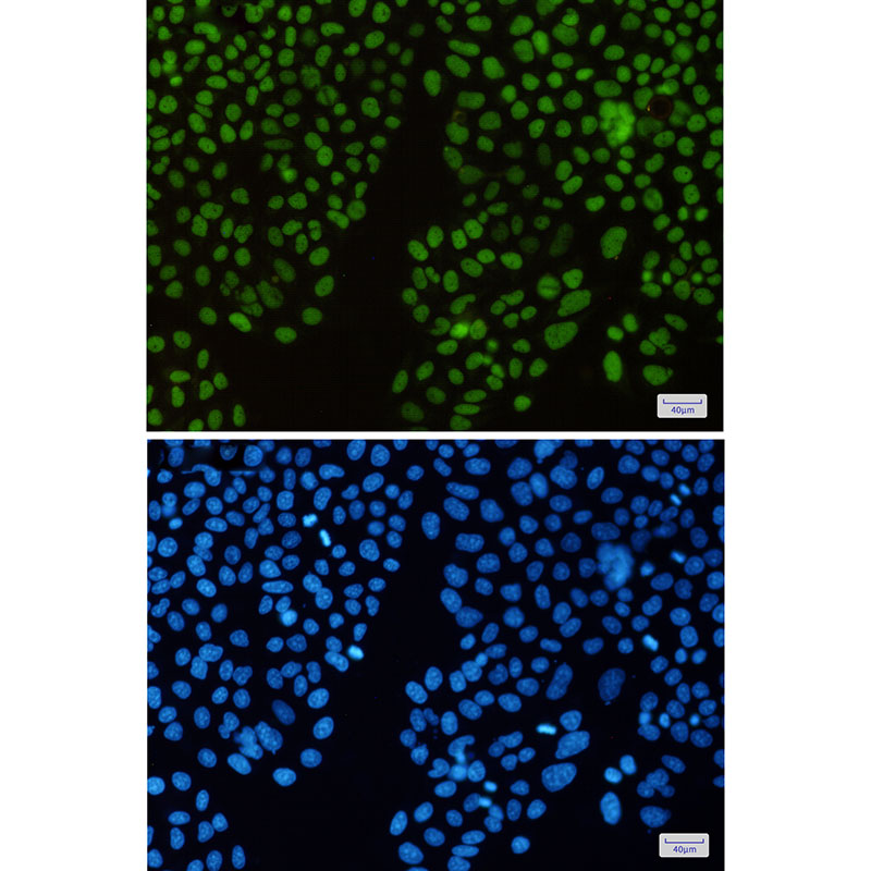 KAT1 Rabbit mAb