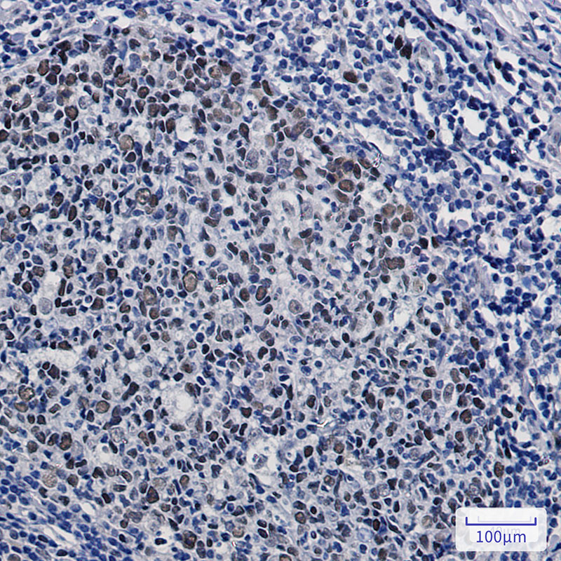 KAT1 Rabbit mAb