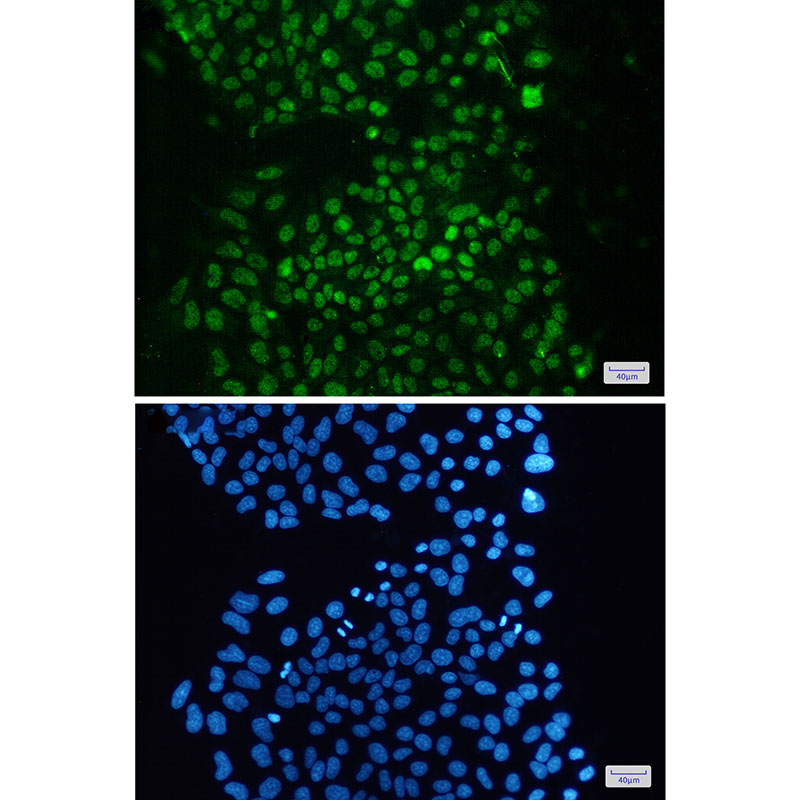 KDM1A Rabbit mAb