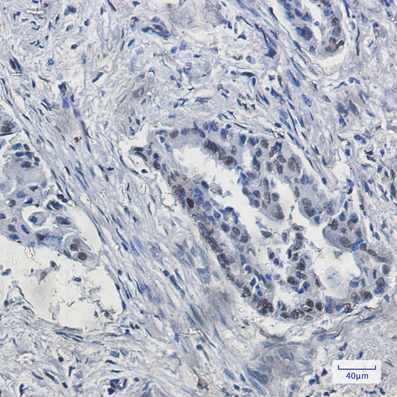 KDM4B Rabbit mAb