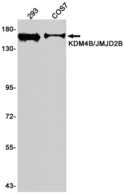 KDM4B Rabbit mAb