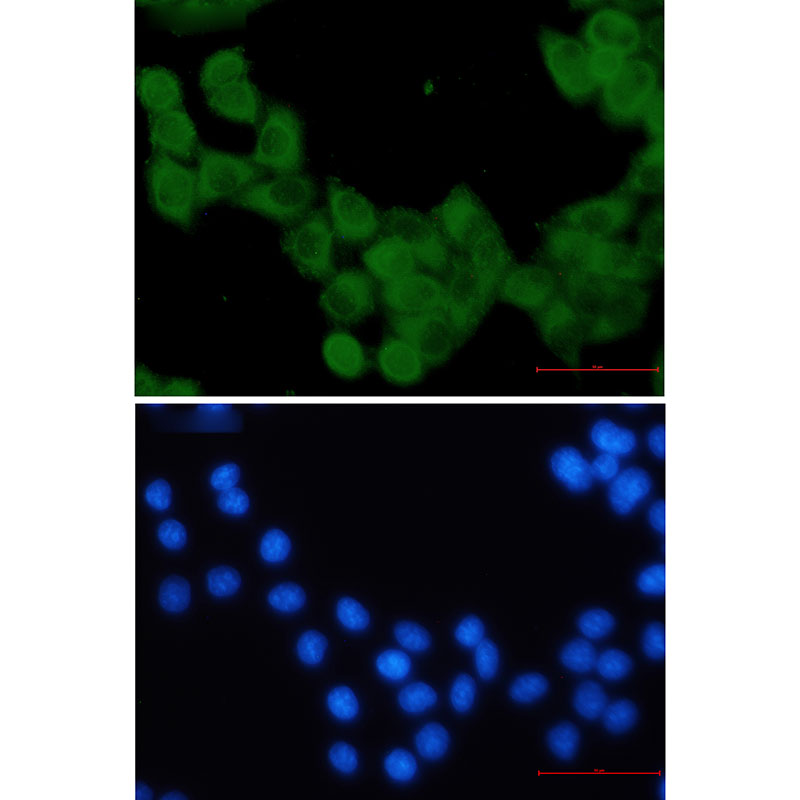 KIF5B Rabbit mAb