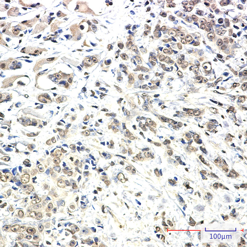 KIF5B Rabbit mAb