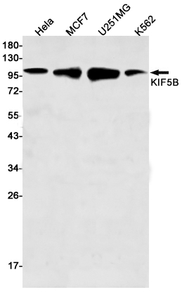 KIF5B Rabbit mAb