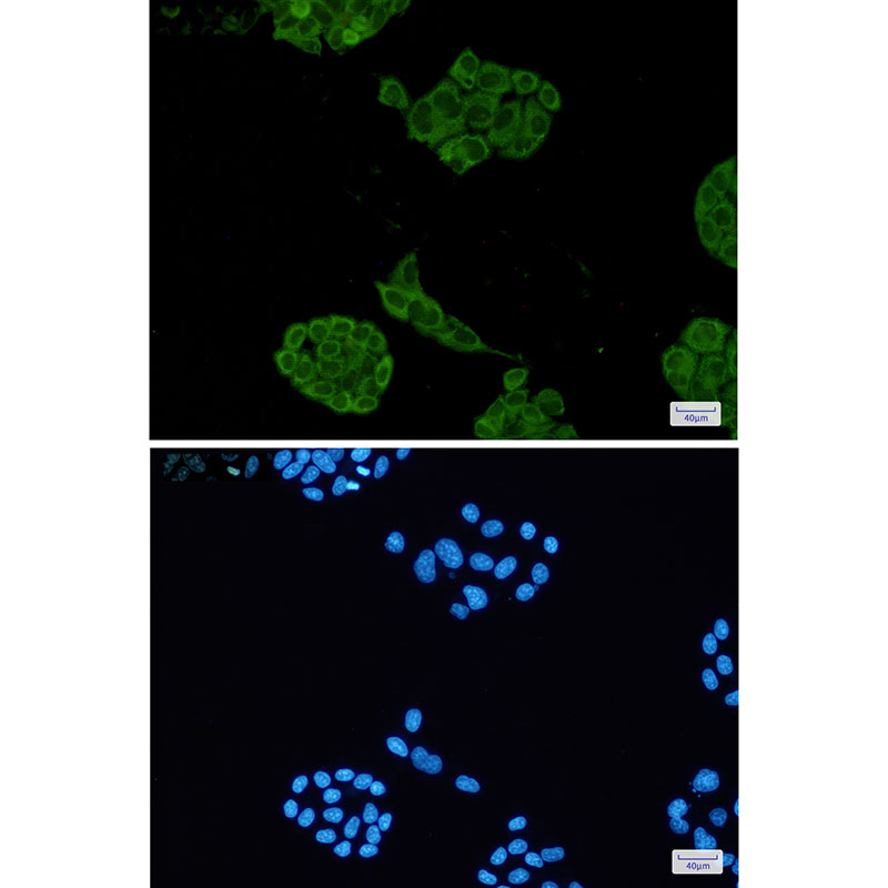 Lactate Dehydrogenase A Rabbit mAb