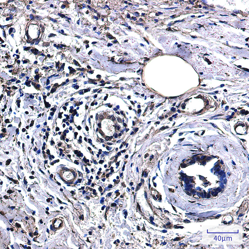 Lactate Dehydrogenase A Rabbit mAb