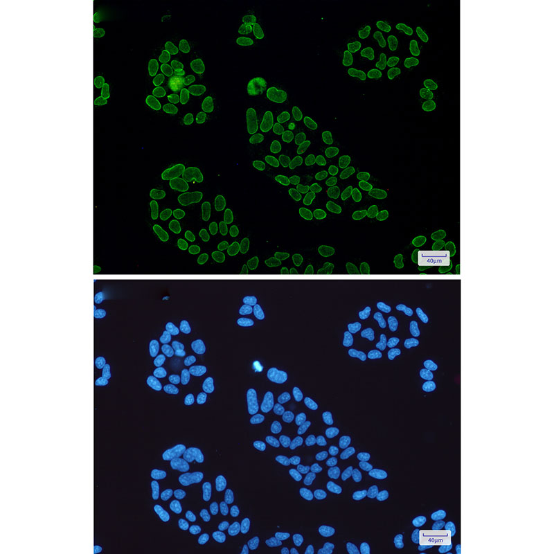 Lamin A/C Rabbit mAb