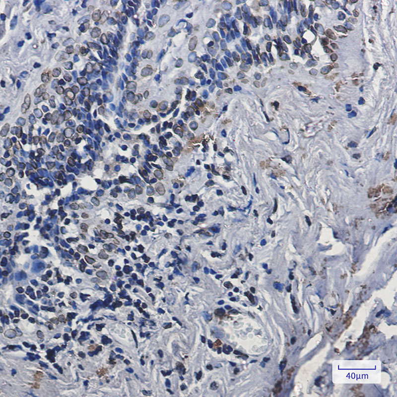 Lamin A/C Rabbit mAb