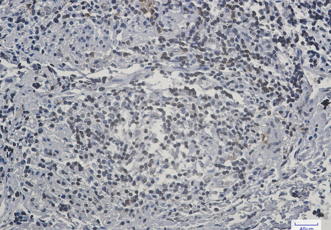 Lamin B Receptor Rabbit mAb