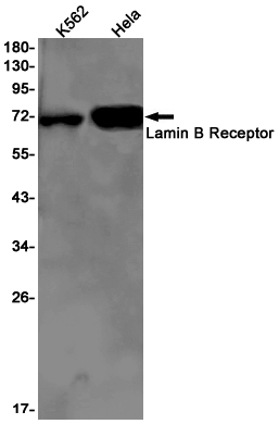 Lamin B Receptor Rabbit mAb