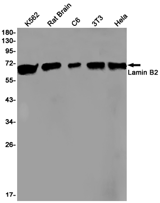 Lamin B2 Rabbit mAb