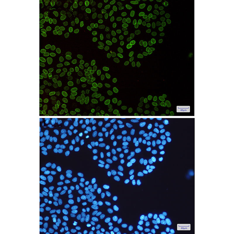 Lamin B2 Rabbit mAb