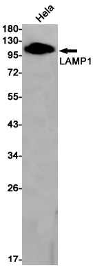 LAMP1 Rabbit mAb