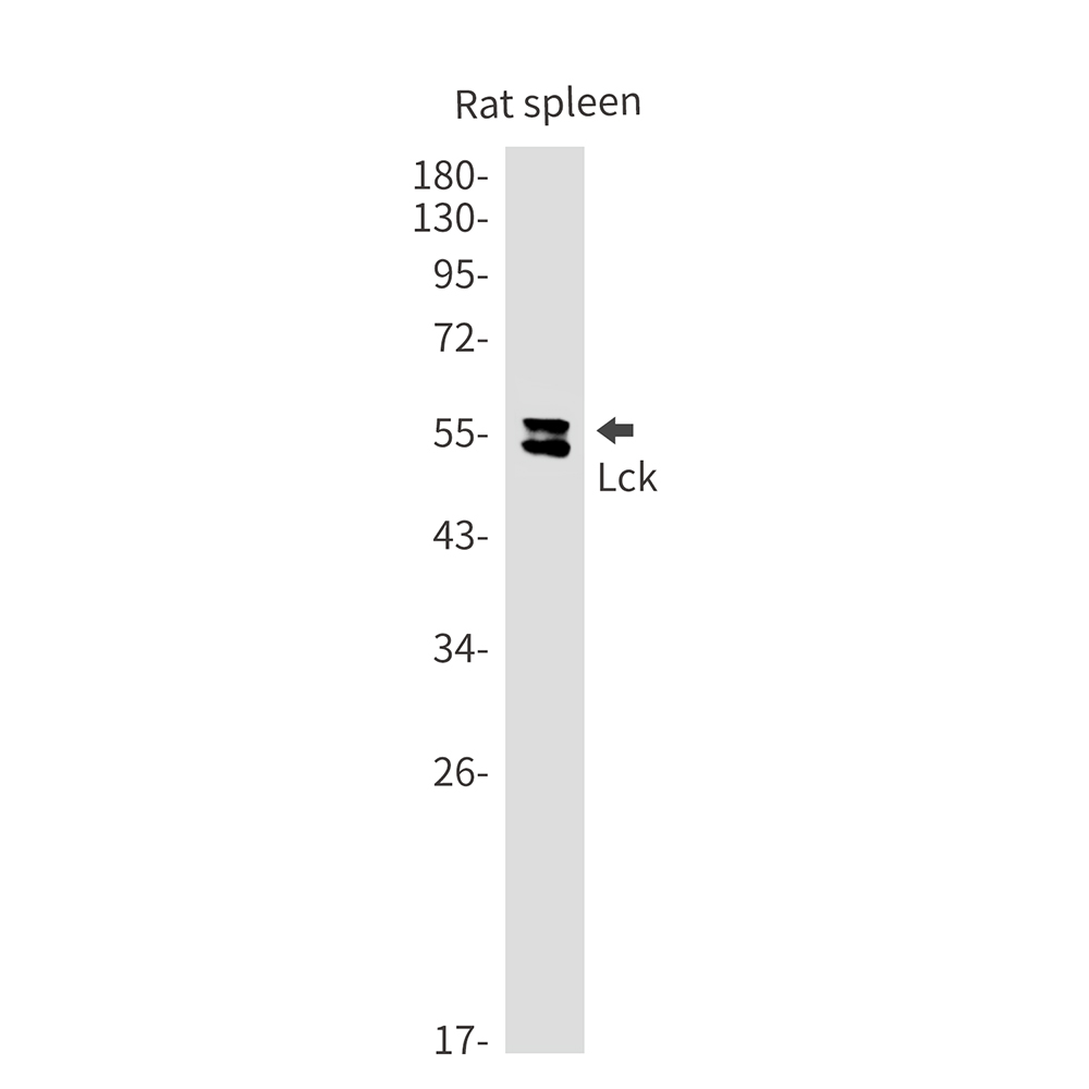 Lck Rabbit mAb