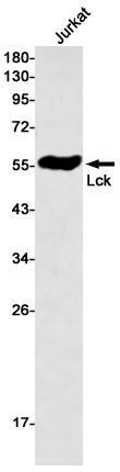 Lck Rabbit mAb