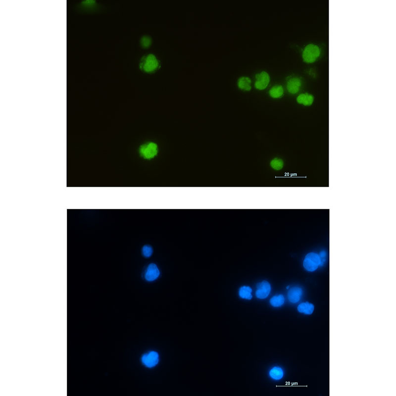 LEF1 Rabbit mAb